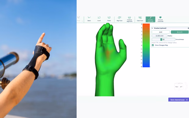 A hand with a black OrthoSolid orthosis, pointing at the sky, next to OrthoSolid’s configurator, where a patient’s hand scan is cleaned and smoothed before the orthosis is fitted