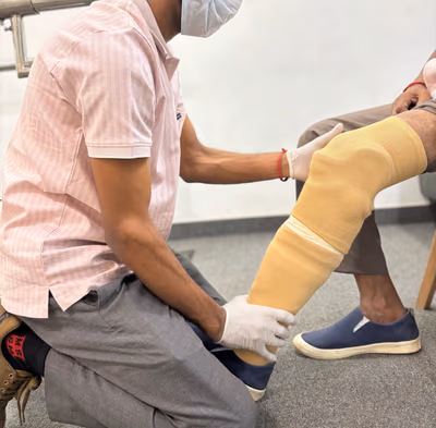 A clinician in gloves fits a 3D-printed prosthetic socket to a patient’s leg