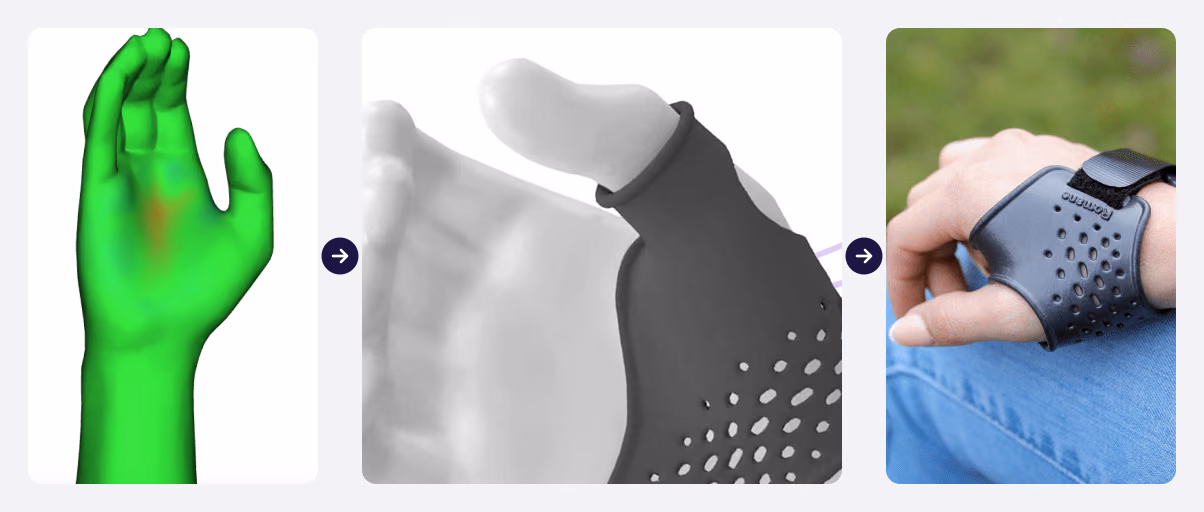 Three steps at OrthoSolid: a 3D scan of a hand, colored by how much the cleaning changed it; the same hand in the configurator with a perforated thumb orthosis fitted to it; and the printed orthosis worn on a wrist.